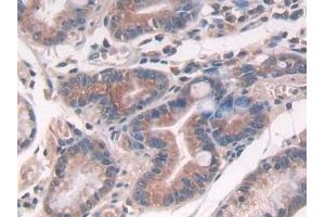 Immunohistochemistry (IHC) image for anti-Interleukin 10 (IL10) (AA 19-178) antibody (ABIN7442330)