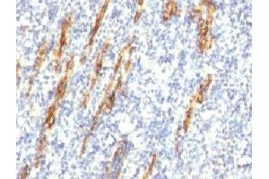 Formalin-fixed, paraffin-embedded human tonsil stained with CD34 antibody (QBEnd/10 + HPCA1/763) (CD34 抗体)