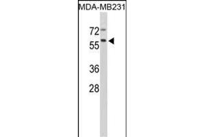 Western blot analysis of CTSF Antibody (Center ) (ABIN390488 and ABIN2840848) in MDA-M cell line lysates (35 μg/lane). (Cathepsin F 抗体  (AA 261-290))