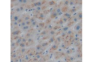 Used in DAB staining on fromalin fixed paraffin- embedded liver tissue (ABAT 抗体  (AA 249-500))