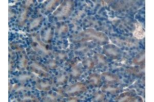 Detection of MMP12 in Mouse Kidney Tissue using Polyclonal Antibody to Matrix Metalloproteinase 12 (MMP12) (MMP12 抗体  (AA 294-473))