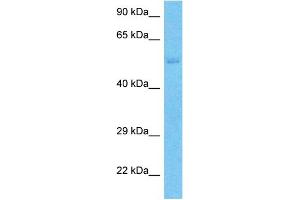 Host:  Rabbit  Target Name:  SLC43A3  Sample Type:  Jurkat Whole Cell lysates  Antibody Dilution:  1. (SLC43A3 抗体  (N-Term))