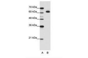 Image no. 2 for anti-DIS3-Like Exonuclease 2 (DIS3L2) (AA 121-170) antibody (ABIN202821) (DIS3L2 抗体  (AA 121-170))