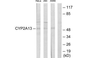 Western Blotting (WB) image for anti-Cytochrome P450, Family 2, Subfamily A, Polypeptide 13 (CYP2A13) (Internal Region) antibody (ABIN1850348) (CYP2A13 抗体  (Internal Region))