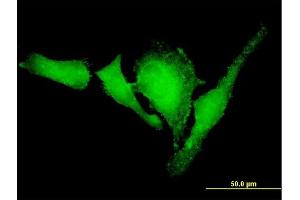 Immunofluorescence of purified MaxPab antibody to VASP on HeLa cell.