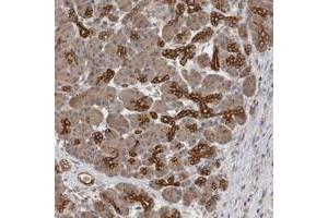 Immunohistochemical staining of human pancreas with SMAP2 polyclonal antibody  shows strong cytoplasmic positivity in pancreatic ducts. (SMAP2 抗体)