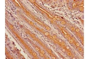 Immunohistochemistry of paraffin-embedded human small intestine tissue using ABIN7149259 at dilution of 1:100 (CYP3A4 抗体  (AA 259-441))