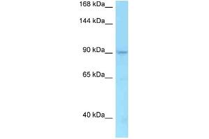WB Suggested Anti-TMEM63A Antibody   Titration: 1. (TMEM63A 抗体  (C-Term))