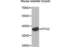 Western blot analysis of extracts of Mouse skeletal muscle cells, using PITX2 antibody. (PITX2 抗体)