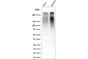 Western Blot Analysis of Raji and Ramos cell lysate using Ki67 Mouse Monoclonal Antibody (MKI67/2461). (Ki-67 抗体  (AA 2293-2478))
