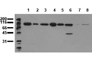 Western Blotting (WB) image for anti-Catenin (Cadherin-Associated Protein), beta 1, 88kDa (CTNNB1) (Exon 3) antibody (ABIN126747) (CTNNB1 抗体  (Exon 3))