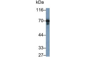 Detection of PTPRO in Rat Cerebrum lysate using Polyclonal Antibody to Protein Tyrosine Phosphatase Receptor Type O (PTPRO) (PTPRO 抗体  (AA 948-1205))
