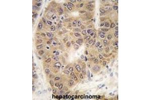 Immunohistochemistry (IHC) image for anti-Small Ubiquitin Related Modifier 4 (SUMO4) (Met55Val-Mutant) antibody (ABIN2996873) (SUMO4 抗体  (Met55Val-Mutant))