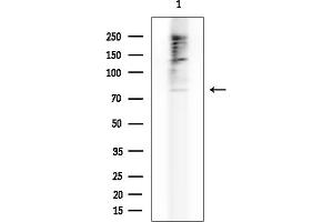 anti-ATP-Binding Cassette, Sub-Family G (WHITE), Member 8 (ABCG8) (Internal Region) antibody