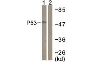 Western blot analysis of extracts from COS7 cells, treated with TSA 400nM 24h, using p53 (Ab-382) Antibody. (p53 抗体  (AA 344-393))