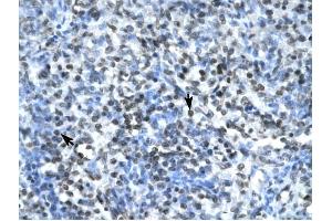 Claudin 17 antibody was used for immunohistochemistry at a concentration of 4-8 ug/ml to stain Spleen cells (arrows) in Human Spleen. (Claudin 17 抗体  (Middle Region))