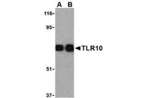 Western blot analysis of TLR10 in human lymph node cell lysates with this product at (A) 0. (TLR10 抗体  (Center))