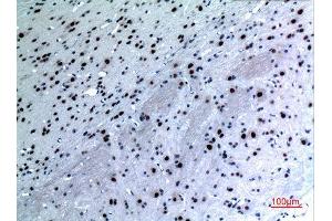 Immunohistochemistry (IHC) analysis of paraffin-embedded Rat Brain, antibody was diluted at 1:100. (KRT14 抗体  (C-Term))