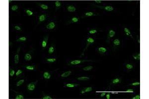 Immunofluorescence (IF) image for anti-Cerebellar Degeneration-Related Protein 2, 62kDa (CDR2) (AA 1-454) antibody (ABIN514315)