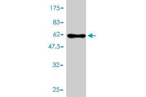 Western Blot detection against Immunogen (61. (HMGCL 抗体  (AA 1-325))