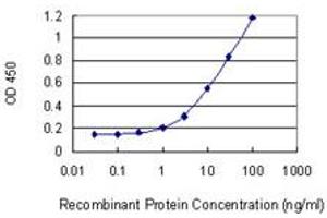 Detection limit for recombinant GST tagged PRKCDBP is 0. (PRKCDBP 抗体  (AA 161-261))