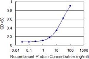 Detection limit for recombinant GST tagged CDYL is 0. (CDYL 抗体  (AA 153-260))