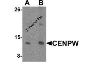 Western Blotting (WB) image for anti-Centromere Protein W (CENPW) (N-Term) antibody (ABIN1587944) (CENPW 抗体  (N-Term))