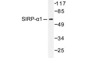 Image no. 1 for anti-Signal-Regulatory Protein alpha (SIRPA) antibody (ABIN271815) (SIRPA 抗体)