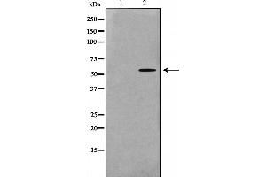Western blot analysis on K562 cell lysate using MAPKAPK5 Antibody，The lane on the left is treated with the antigen-specific peptide.