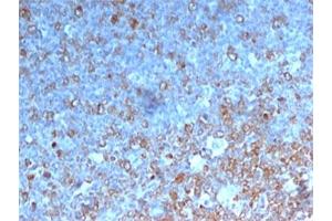IHC testing of human tonsil stained with Cdk1 antibody. (CDK1 抗体)