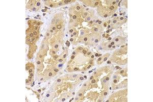 Immunohistochemistry of paraffin-embedded human kidney using PHF21B antibody at dilution of 1:100 (40x lens). (PHF21B 抗体)