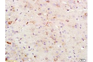 Formalin-fixed and paraffin embedded rat brain labeled with Anti KSR1 Polyclonal Antibody, Unconjugated (ABIN700645) at 1:200 followed by conjugation to the secondary antibody and DAB staining (KSR1 抗体  (AA 601-750))