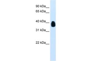 Western Blotting (WB) image for anti-Ets Variant 7 (ETV7) antibody (ABIN2461239) (ETV7 抗体)