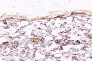 Immunohistochemistry (Paraffin-embedded Sections) (IHC (p)) image for anti-Kinesin Family Member 5B (KIF5B) antibody (ABIN7074440)