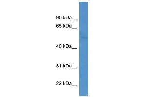 Western Blotting (WB) image for anti-Coronin, Actin Binding Protein, 2B (CORO2B) (C-Term) antibody (ABIN928604)