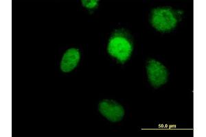 Immunofluorescence of purified MaxPab antibody to POLB on HeLa cell. (POLB 抗体  (AA 1-335))