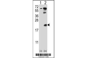 Western blot analysis of UBE2B using rabbit polyclonal UBE2B Antibody (E132) using 293 cell lysates (2 ug/lane) either nontransfected (Lane 1) or transiently transfected (Lane 2) with the UBE2B gene. (UBE2B 抗体  (C-Term))