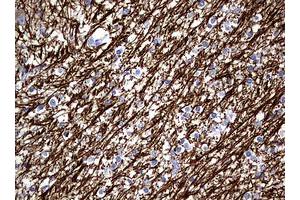Image no. 2 for anti-Neurofilament, Light Polypeptide (NEFL) (AA 1-360) antibody (ABIN1490762) (NEFL 抗体  (AA 1-360))