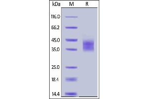 SDS-PAGE (SDS) image for Interleukin 2 Receptor, alpha (IL2RA) (AA 22-213) (Active) protein (His tag,AVI tag,Biotin) (ABIN6731243)