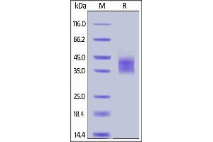 Biotinylated Human IL-2 R alpha, His,Avitag on  under reducing (R) condition. (CD25 Protein (AA 22-213) (His tag,AVI tag,Biotin))