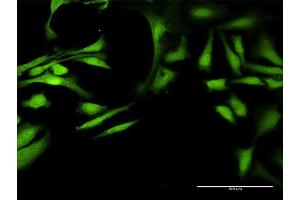 Immunofluorescence of purified MaxPab antibody to ALDH7A1 on HeLa cell. (ALDH7A1 抗体  (AA 1-511))