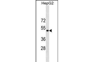 ST6GAL1 Antibody (Center) (ABIN1881841 and ABIN2838853) western blot analysis in HepG2 cell line lysates (35 μg/lane). (ST6GAL1 抗体  (AA 178-206))
