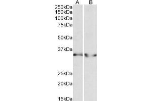 ABIN1782167 (0. (LDHB 抗体  (AA 15-25))