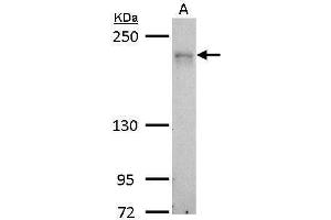 WB Image MRCK alpha antibody detects CDC42BPA protein by Western blot analysis. (CDC42BPA 抗体)