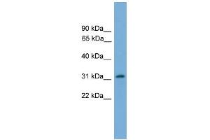 WB Suggested Anti-PIGL Antibody Titration:  0. (PIGL 抗体  (N-Term))