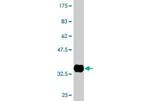 Western Blot detection against Immunogen (34. (Centrin 1 抗体  (AA 16-94))