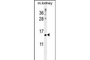 MORN5 Antibody (C-term) (ABIN656139 and ABIN2845478) western blot analysis in mouse kidney tissue lysates (35 μg/lane). (MORN5 抗体  (C-Term))