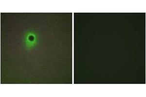 Immunofluorescence analysis of A549 cells, using HIPK4 Antibody. (HIPK4 抗体  (AA 511-560))