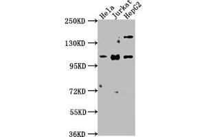 Western Blot Positive WB detected in: Hela whole cell lysate, Jurkat whole cell lysate, HepG2 whole cell lysate All lanes: KSR1 antibody at 1:2000 Secondary Goat polyclonal to rabbit IgG at 1/50000 dilution Predicted band size: 103, 98, 88, 85 kDa Observed band size: 103 kDa (KSR1 抗体  (AA 404-598))