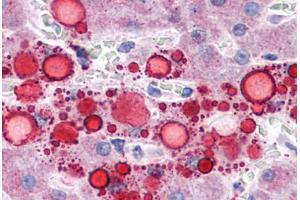 Human Liver, Lipid Droplets: Formalin-Fixed, Paraffin-Embedded (FFPE) (ADRP 抗体  (AA 28-281))